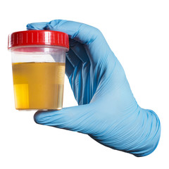 Hand in a blue glove holding medical urine test, isolated on white background