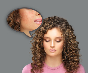 Fototapeta premium Post-Acne Marks /Treating Acne Scars.Acne Scar Removal