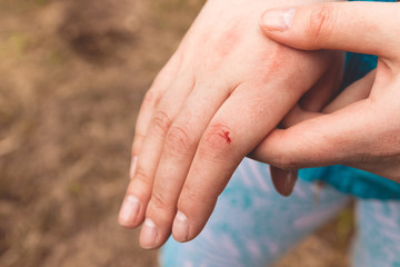 Finger on right human hand is cut hurt and bleeding with bright red blood