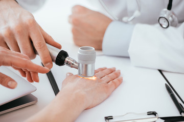 cropped view of dermatologist examining hand of woman while holding dermatoscope in clinic