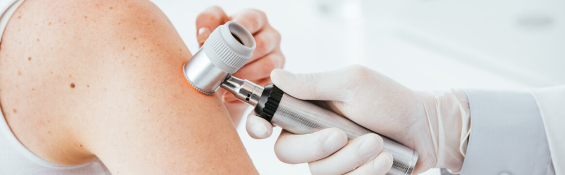 panoramic shot of dermatologist in latex glove holding dermatoscope while examining patient