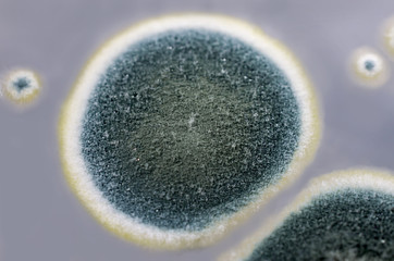 Colonies of Penicillium fungi grown on Sabouraud Dextrose Agar. Penicillium is a mold fungus that causes food spoilage, used in cheese production and produces antibiotic penicillin