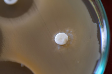 Drug testing of microbiology laboratory.