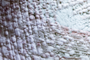 Backgrounds of Colony Characteristics of Mold under the microscope.