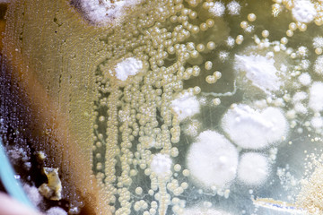 Backgrounds of Colony Characteristics of Mold under the microscope.