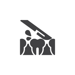 Dental surgery vector icon. Tooth and medical knife filled flat sign for mobile concept and web design. Human teeth and scalpel glyph icon. Symbol, logo illustration. Pixel perfect vector graphics