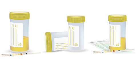 Urine sample set, full and empty containers. Vector illustration, eps 10