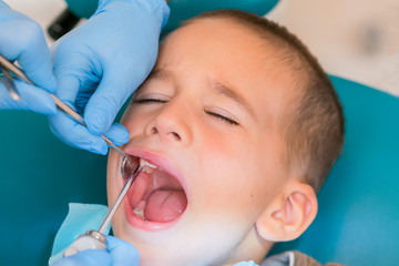 A little boy at a dentist's reception in a dental clinic. Children's dentistry, Pediatric Dentistry. A female stomatologist is treating teeth of a school-age boy. Oral health and hygiene