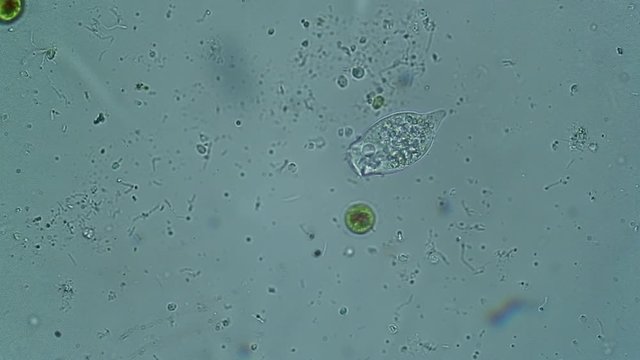 microscopic green algae and vorticellas in a pond's drop observed at microscope