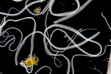 The study of Tapeworm infection is caused by ingesting food or water contaminated with tapeworm...