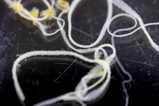 The study of Tapeworm infection is caused by ingesting food or water contaminated with tapeworm eggs or larvae in laboratory.