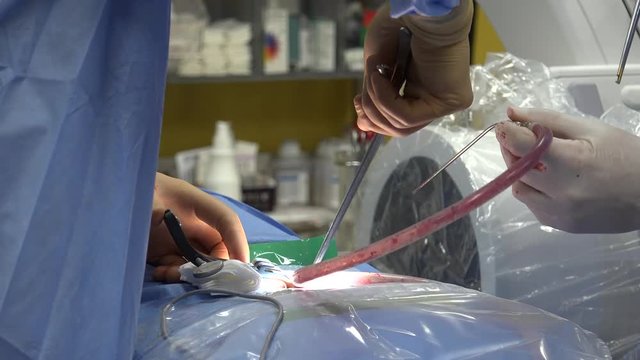 Minimally invasive spine surgery, also known as MISS, has no specific meaning or definition. Basically, it is marketing language that implies a lack of severe invasion, that may or may not be the case