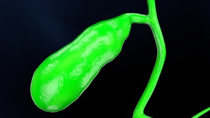 3d rendered medically accurate illustration of a diseased gallbladder