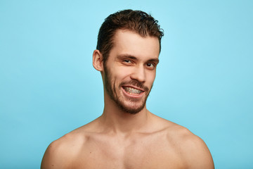 smiling man showing his teeth, dental braces to the camera, teeth care, health care,alighing and straightening teeth, improvement of dental health