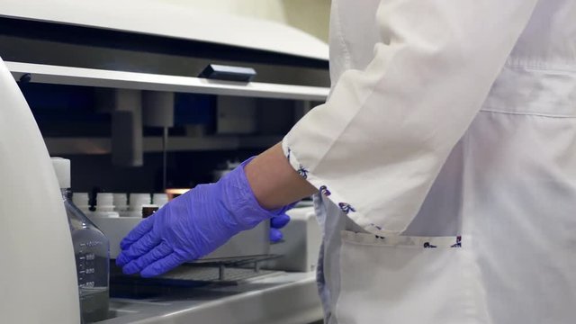 Woman laboratory assistant in a white coat and blue gloves sets up reagents in an automatic biochemical and immunofermental blood analyzer