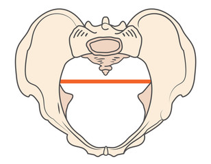 Anthrepoid Pelvis Shape with Round - Oval shape
