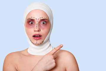 Beautiful woman before plastic surgery with bandaged face. Girl looks shocked, points fore finger...
