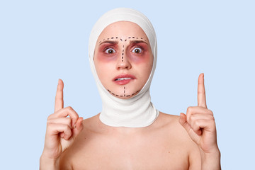 Closeup of female facial expressing . Surprised, scered and shocked lady waits for medical procedure. Woman in bandage on head bites lip and points forefingers up. Plastic surgery concept .