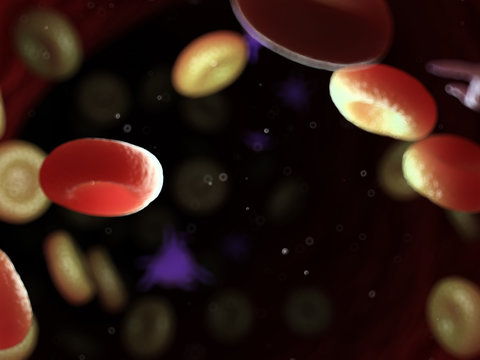 3d rendered medically accurate illustration of diseased blood cells