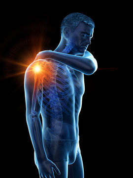 3d rendered medically accurate illustration of a man having a painful shoulder joint