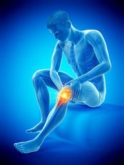 Obraz premium 3d rendered medically accurate illustration of a man having a painful knee