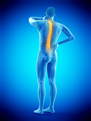 3d rendered medically accurate illustration of a man having a backache