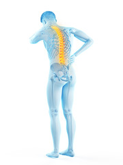 3d rendered medically accurate illustration of man having a backache
