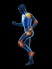 3d rendered medically accurate illustration of a walking man with painful jonts