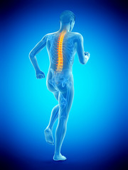 3d rendered medically accurate illustration of a walking man with a painful back