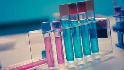 Test tubes and flasks in a chemical laboratory
