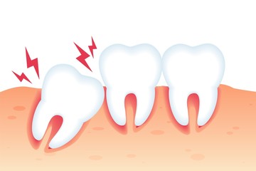 Vector Illustration Pain from Wrong Bite Flat.
