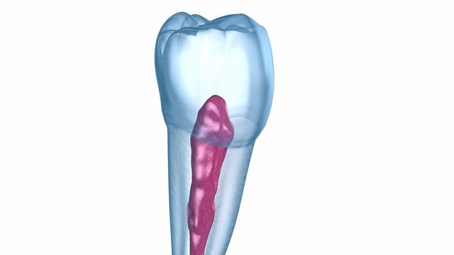 Dental root anatomy - Mandibular Second premolar tooth. Medically accurate dental 3D illustration