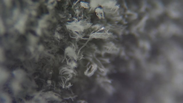 Mold under the microscope. GMO. DNA. Black Mold taken from rotten bread , under a microscope. Colony of mold with spores on a bread crust. Allergy, poisoning, fungus.