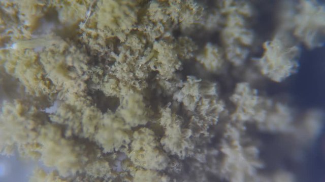 Mold under the microscope. GMO. DNA. Black Mold taken from rotten bread , under a microscope. Colony of mold with spores on a bread crust. Allergy, poisoning, fungus.