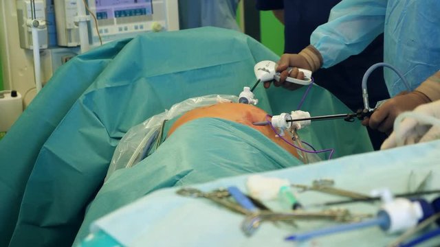Surgeons are operating a human body with special stems