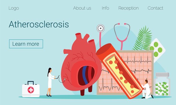 Heart Medication Solution Tiny People Atherosclerosis, EKG , Muga Scan, Cardiology,  Hypotension And Hypertens/ Coronary Artery Concept Vector For Mobile Website Development, Apps Is Presented.