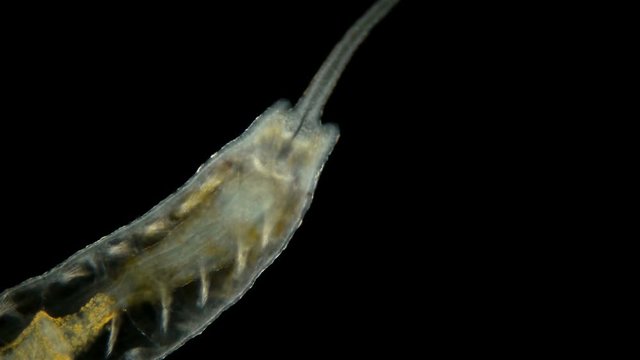 worm of the family Naididae under a microscope, the lower part of the worm's head, where the mouth is visible, Stylaria lacustris view, low-nebula Oligochaeta worm, pond dweller, diverse life in