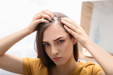 Young woman with hair loss problem indoors
