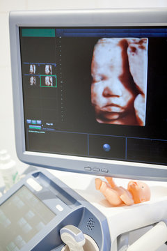Model of image of mature fetus is on ultrasonographer monitor screen, face of baby
