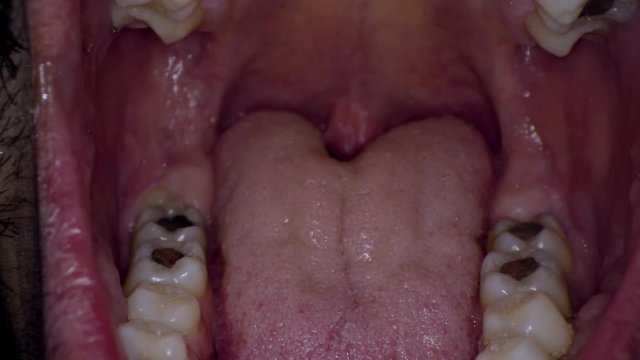 	man's throat from the inside close up