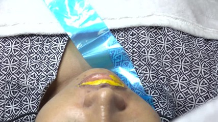 A cosmetologist woman permanent lip makeup in a beauty salon and puts a needle on her lips with  paint. The view from the top