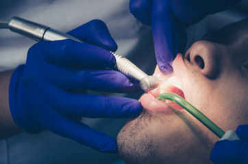 Seated young man is being examined his teeth by a dentist