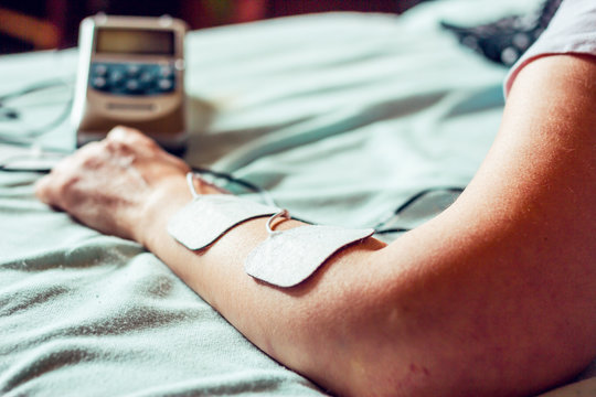 Small electro stimulator for home use with electrodes paced on a woman’s hand – Electric device used in healthcare for massage and fitness – Equipment for pain relief and muscle building