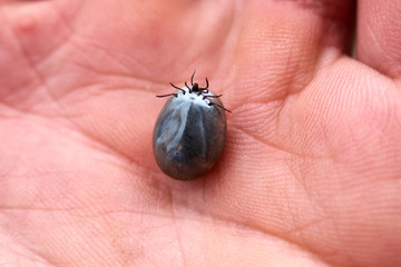 Tick maximum filled with blood sitting on human skin ,