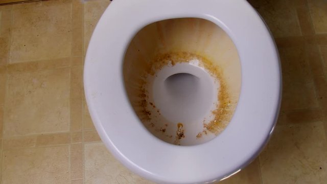 Dirty toilet bowl.