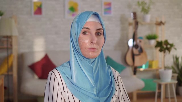 Young muslim woman in hijab with a burn scar on her face looking at the camera