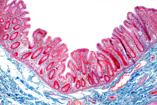 Human large intestine tissue under microscope view.