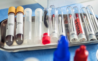 Different samples hair and blood to analyze in the laboratory scientific, conceptual image