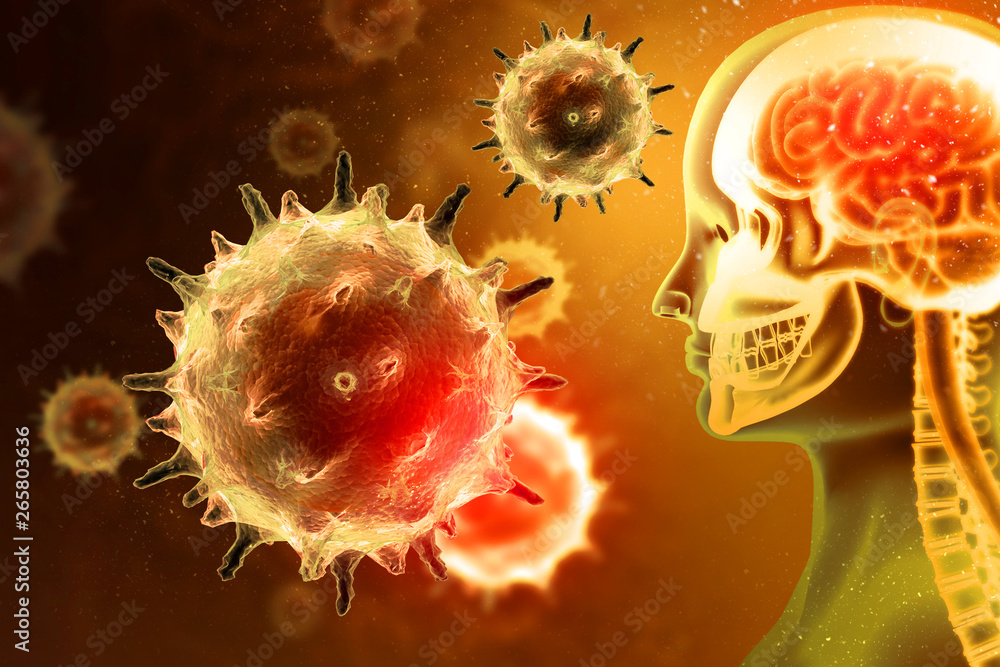 Wall mural virus or bacteria attacking the human brain. viral disease