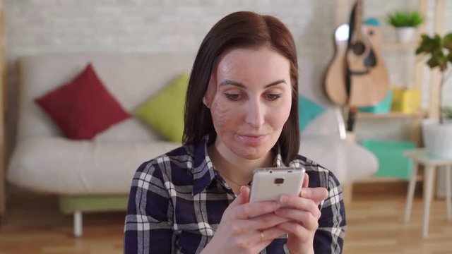 Close up young woman with a burn scar on her face using a smartphone
